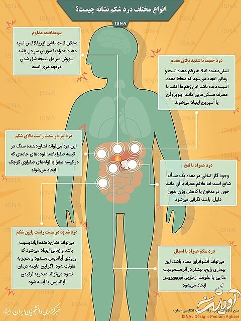 انواع مختلف درد شکم نشانه چیست؟ / اینفوگرافیک